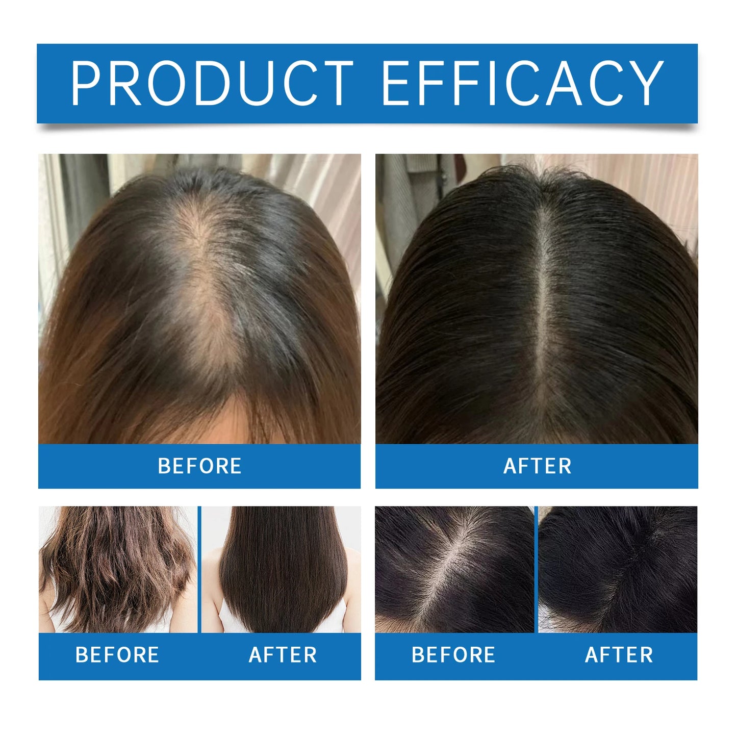 Civara Hair Growth Oil™